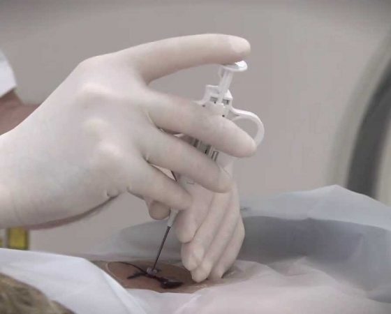 Radiology & Diagnostic Services Armadale Biopsy